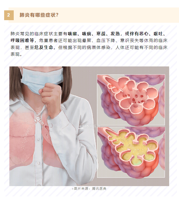 1698282479880457.png image.png